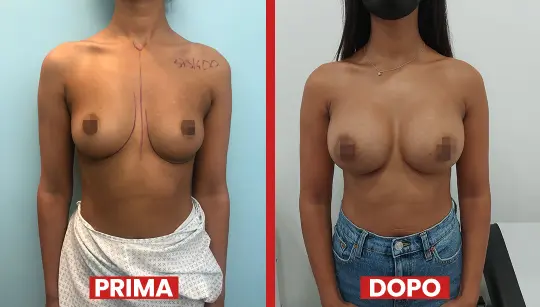 Prima-dopo1