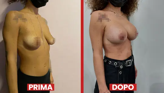 Prima-dopo11