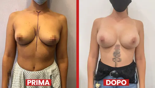 Prima-dopo4
