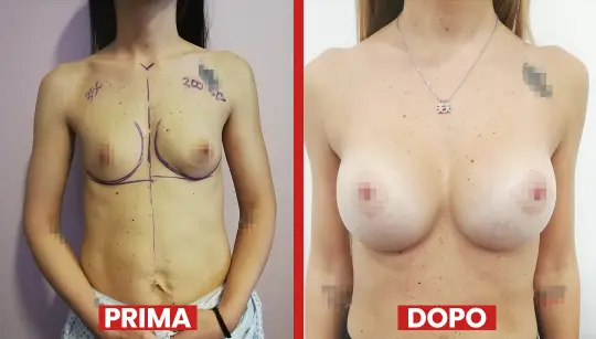 Prima-dopo5