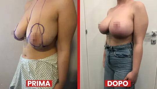 Prima-dopo7